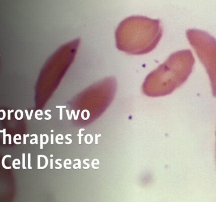 The United States has given its approval for two gene therapies to be used in the treatment of sickle cell disease.