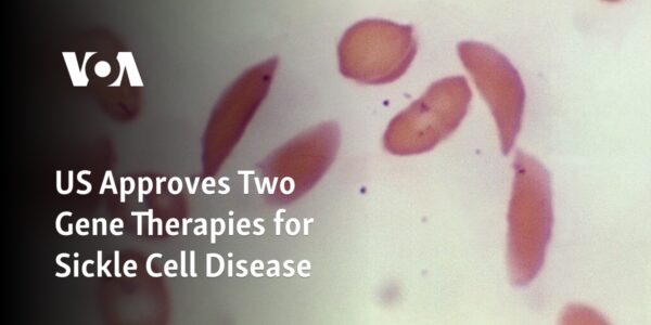 The United States has given its approval for two gene therapies to be used in the treatment of sickle cell disease.