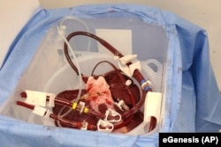 The experiment demonstrated that pig livers could potentially be used for human transplants in the future.