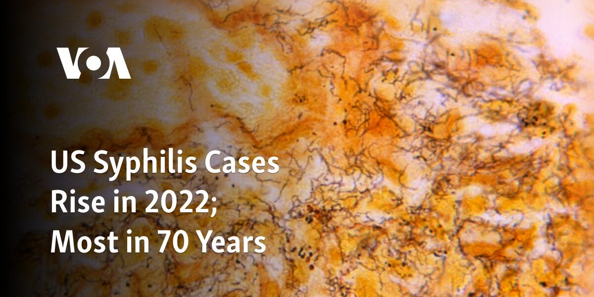 The number of syphilis cases in the US has increased in 2022, reaching the highest level in 70 years.