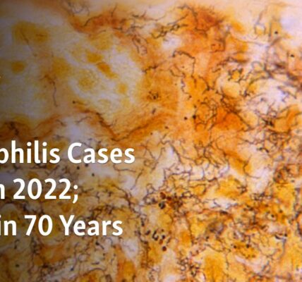 The number of syphilis cases in the US has increased in 2022, reaching the highest level in 70 years.