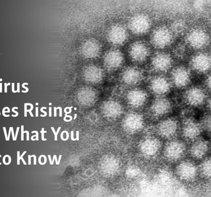 The number of cases of Norovirus sickness is increasing; Here are the essential details you should be aware of.