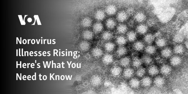 The number of cases of Norovirus sickness is increasing; Here are the essential details you should be aware of.