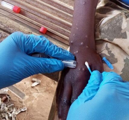 Europe can defeat mpox, must support Africa in getting vaccines: WHO