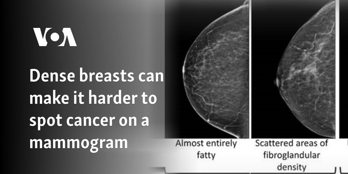 Dense breasts can make it harder to spot cancer on a mammogram