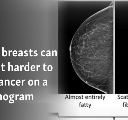 Dense breasts can make it harder to spot cancer on a mammogram