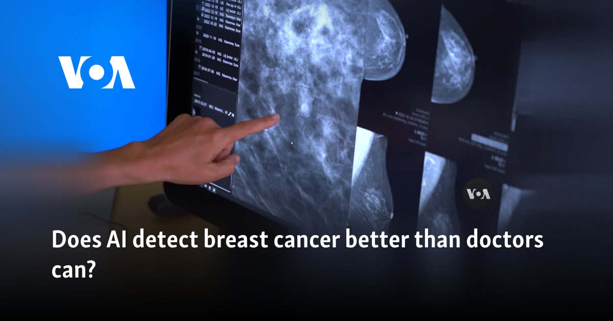 Does AI detect breast cancer better than doctors can?